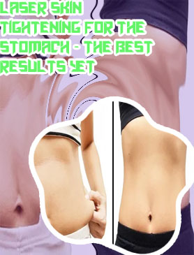 Best treatment to tighten stomach skin