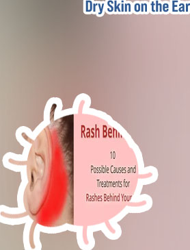 Dry skin flakes in ear
